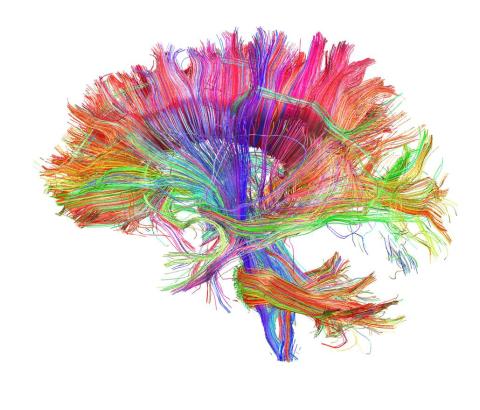 Brain networks Brain networks